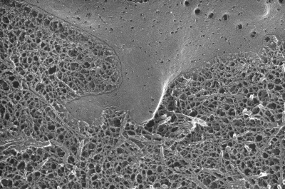 Image courtesy of Robert Mecham. Freeze fracture image of cell surrounded by extracellular matrix in native tissue